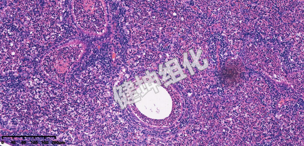 HE与特殊染色样片缩略图12