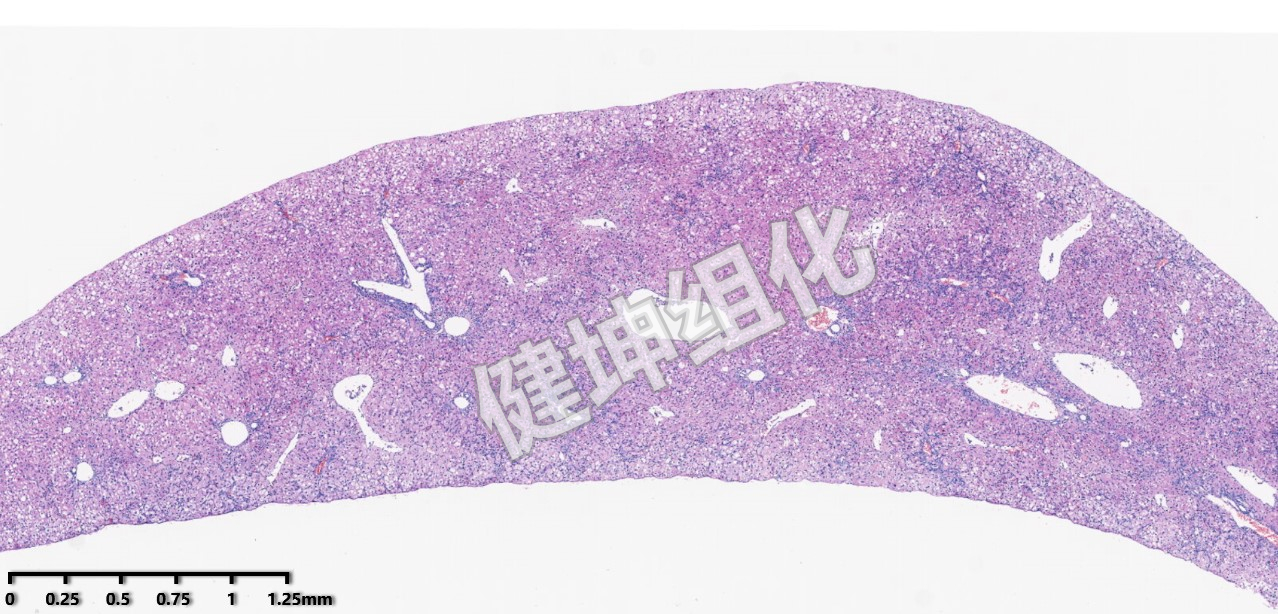 HE与特殊染色样片缩略图17