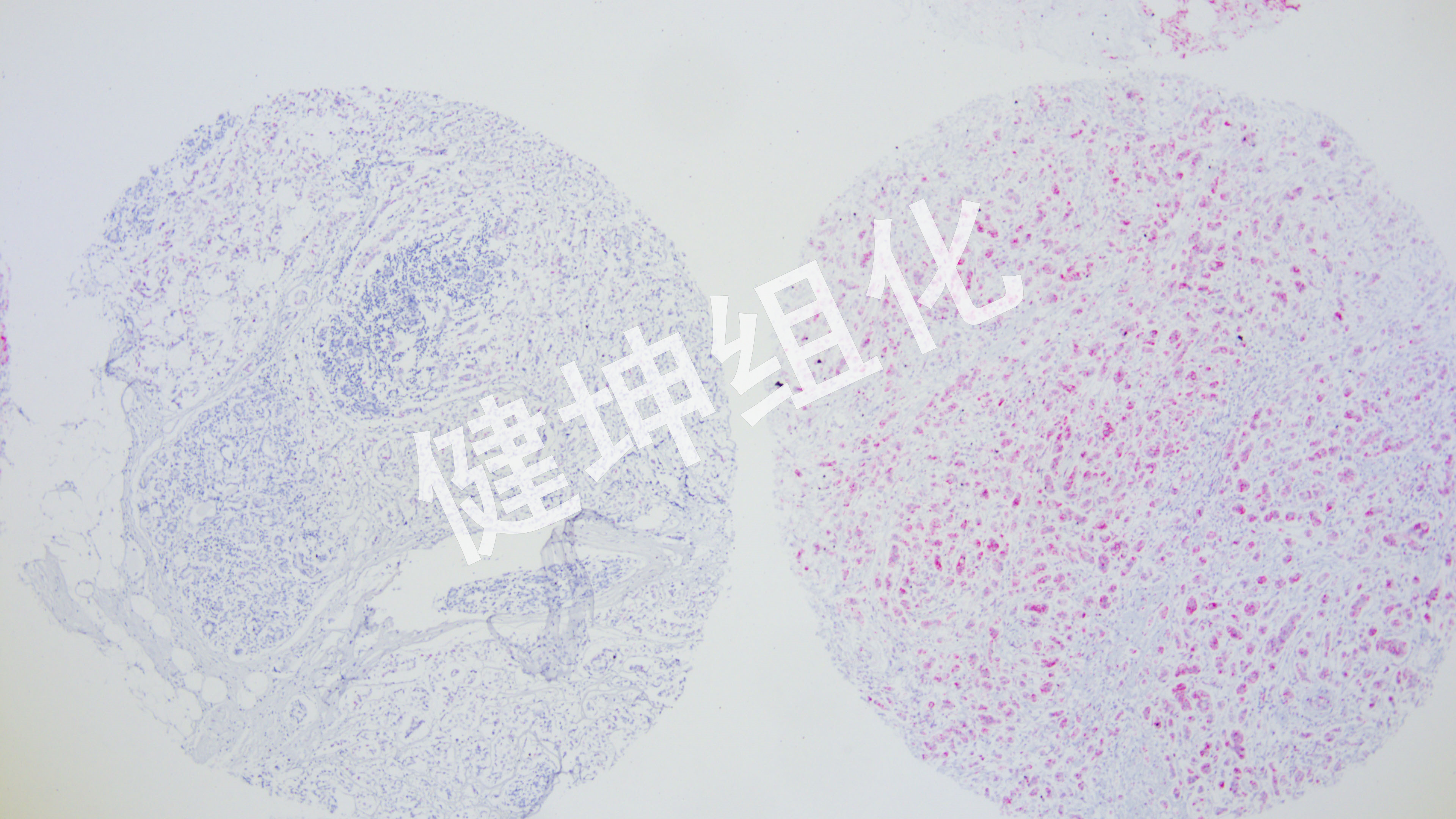 HE与特殊染色样片缩略图28